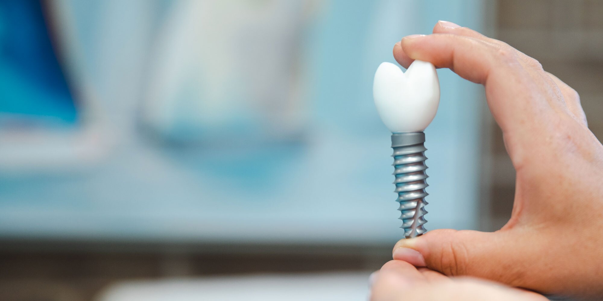 implant model being heldby dr mann